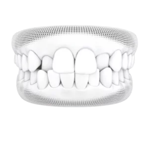 Crossbite 300x300