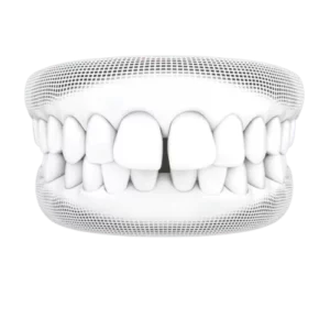 Gapped 300x300